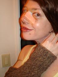 Click image for larger version. 

Name:	melissa755rhinoplastyday2a_176.jpg 
Views:	4541 
Size:	309.2 KB 
ID:	206471