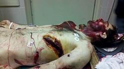 Click image for larger version. 

Name:	boston-bomber-dead-body-photo.jpg 
Views:	344 
Size:	64.1 KB 
ID:	575009
