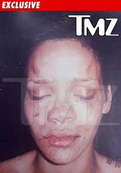 Click image for larger version. 

Name:	0219_rihanna_photo_beating_186.jpg 
Views:	2362 
Size:	17.9 KB 
ID:	226755