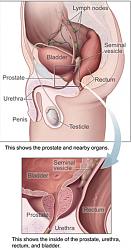 Click image for larger version. 

Name:	Prostatelead.jpg 
Views:	350 
Size:	96.0 KB 
ID:	379575