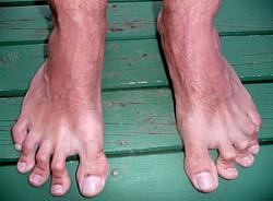 Click image for larger version. 

Name:	ugly-feet-5.jpg 
Views:	620 
Size:	19.3 KB 
ID:	720907