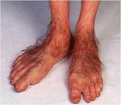 Click image for larger version. 

Name:	hobbit_feet.jpg 
Views:	629 
Size:	22.6 KB 
ID:	720908