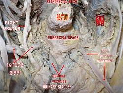 Click image for larger version. 

Name:	800px-Male_pelvic_cavity.jpg 
Views:	5863 
Size:	118.2 KB 
ID:	547638