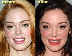 Click image for larger version. 

Name:	wrong_plastic_surgery.jpg 
Views:	592 
Size:	39.6 KB 
ID:	464127