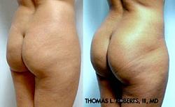 Click image for larger version. 

Name:	buttocks17192A.jpg 
Views:	1407 
Size:	14.8 KB 
ID:	357159