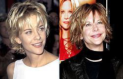 Click image for larger version. 

Name:	Meg-Ryan-Before-and-After-Plastic-Surgery.jpg 
Views:	600 
Size:	54.2 KB 
ID:	464130
