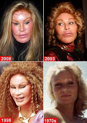 Click image for larger version. 

Name:	jocelyn_wildenstein_203.jpg 
Views:	459 
Size:	71.6 KB 
ID:	282536