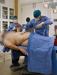 Click image for larger version. 

Name:	liposuction_567.jpg 
Views:	1362 
Size:	23.9 KB 
ID:	233833