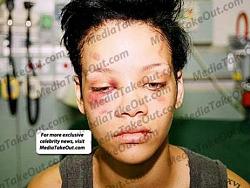 Click image for larger version. 

Name:	rihanna-beat-up-bruised-face_463x349.jpg 
Views:	440 
Size:	28.3 KB 
ID:	456080