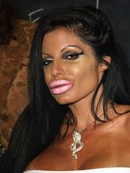 Click image for larger version. 

Name:	Awful-plastic-surgery-results37.63605400.jpg 
Views:	658 
Size:	123.4 KB 
ID:	792863