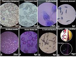 Click image for larger version. 

Name:	foldscope Prakash-Foldscope2014+copy_011.jpg 
Views:	69 
Size:	80.0 KB 
ID:	925974